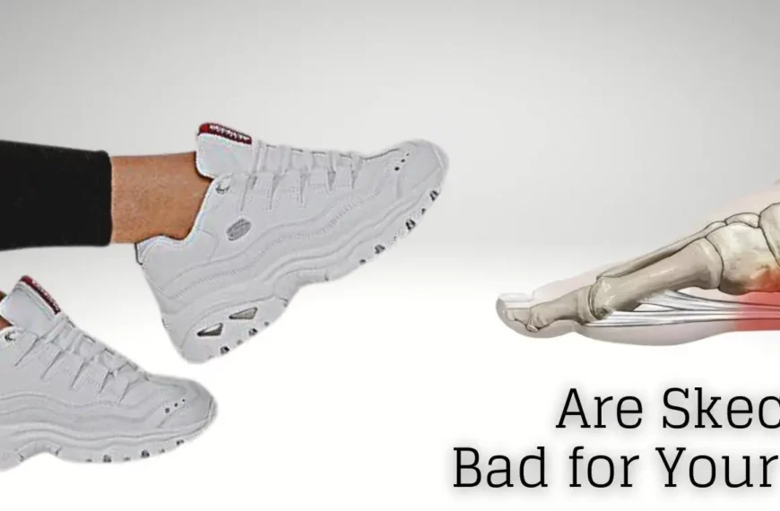 Are Skechers Bad for Your Feet?