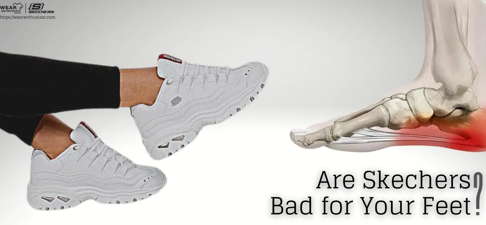 Are Skechers Bad for Your Feet?