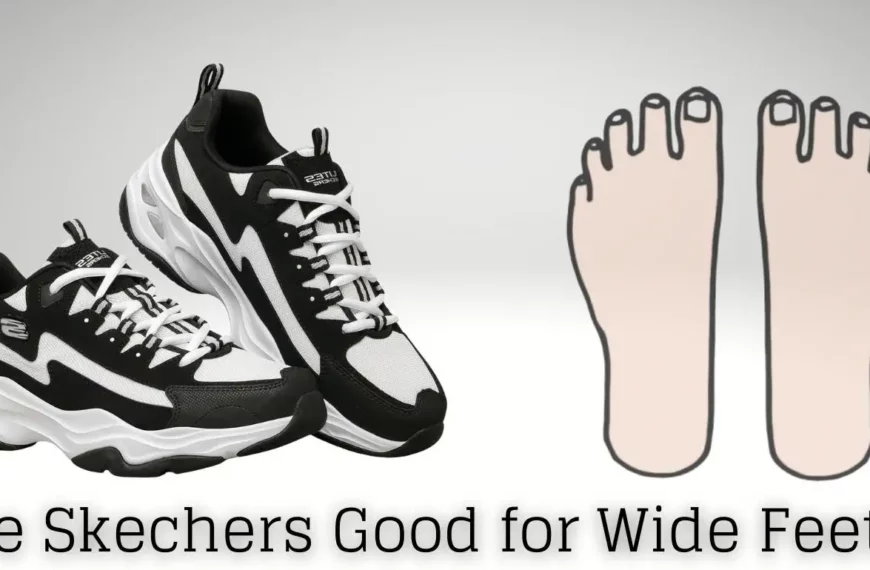 Are Skechers good for wide feet?