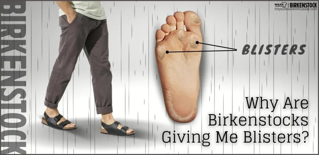 Are Birkenstocks Giving You Blisters? 6 Ways to Prevent It