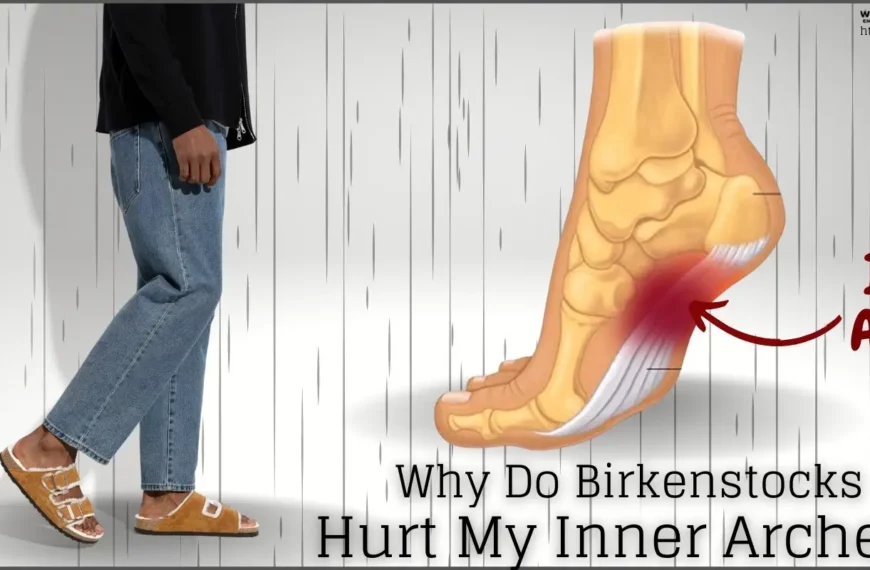 Why Do Birkenstocks Hurt My Inner Arches?